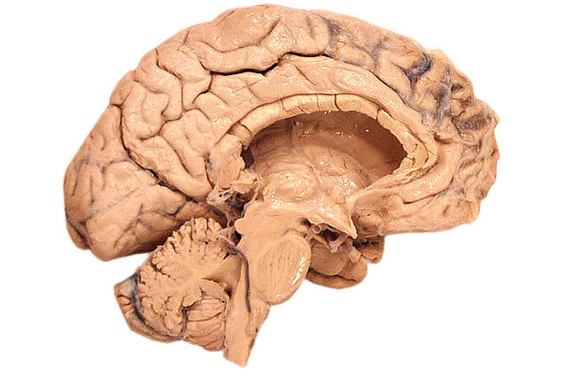 link-between-vision-and-emotion-in-brain-can-help-alzheimers-and-panic-disorders